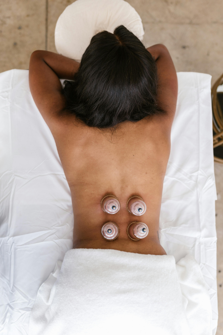 physiotherapy and wellness clinic in Scarborough-cupping therapy